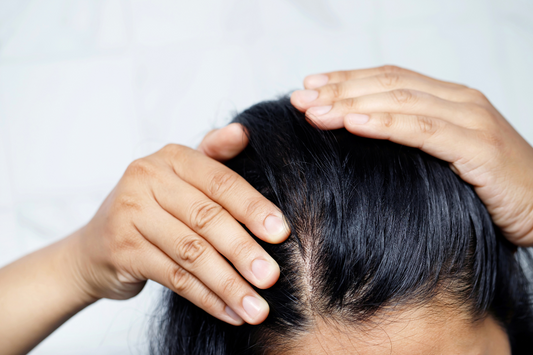 Can Supplements Really Help With Hair Loss?